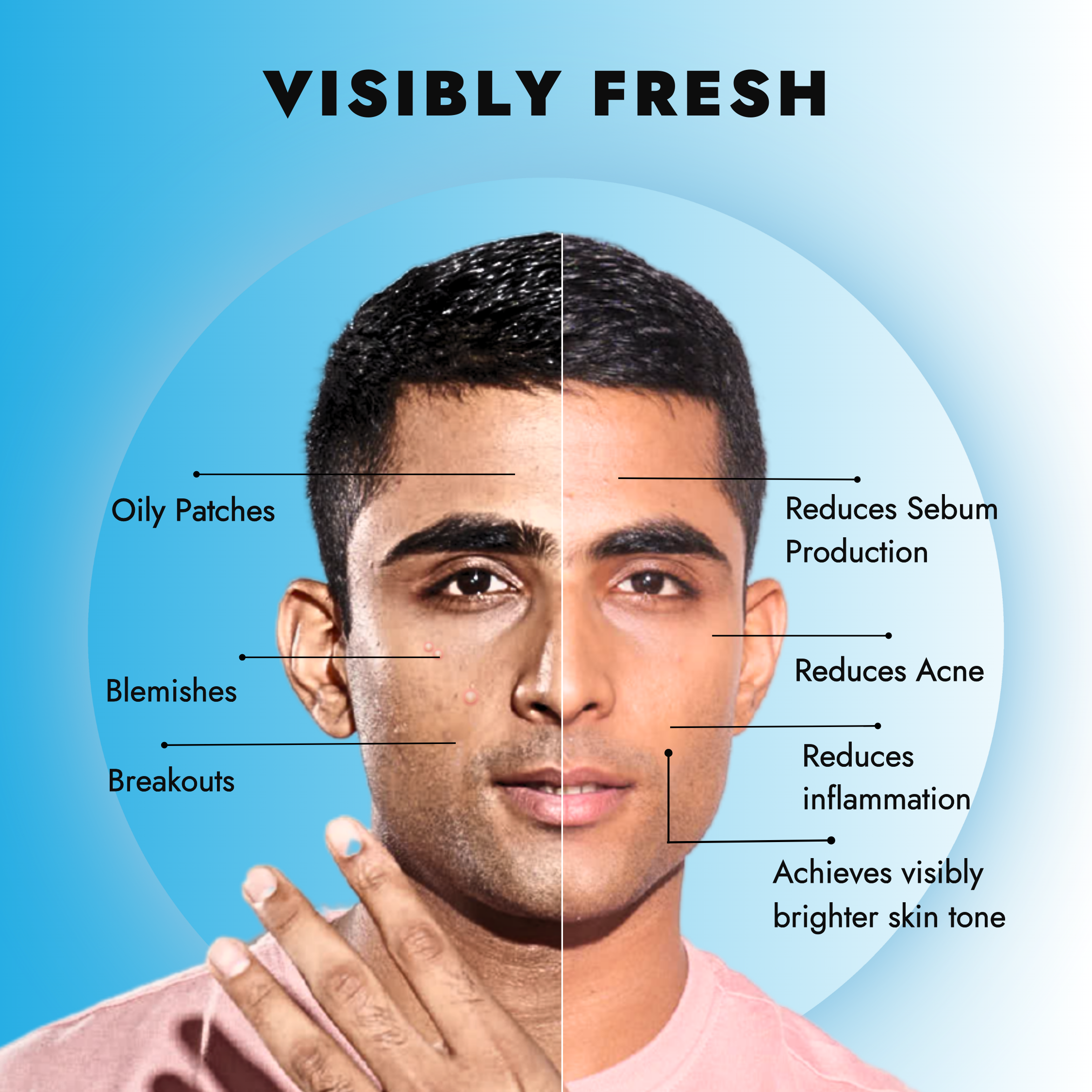 no oily patches and breakouts, reduces acne